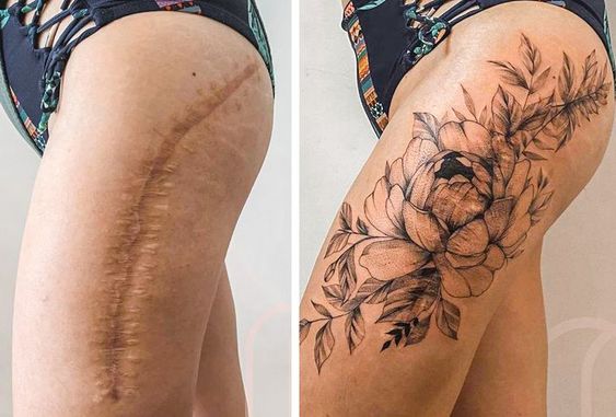 feminine scar cover ups tattoo